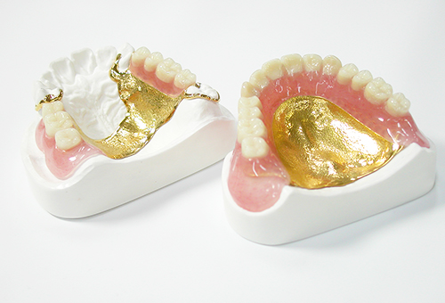 自費の入れ歯について