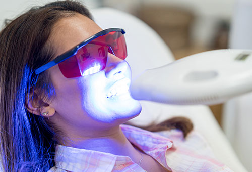 ホワイトニングの種類