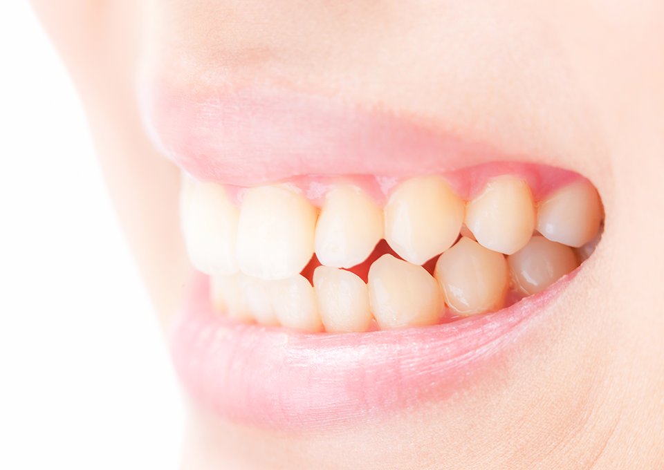 歯ぎしり・食いしばり